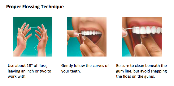 Oral Hygiene Brisbane Elite Dental